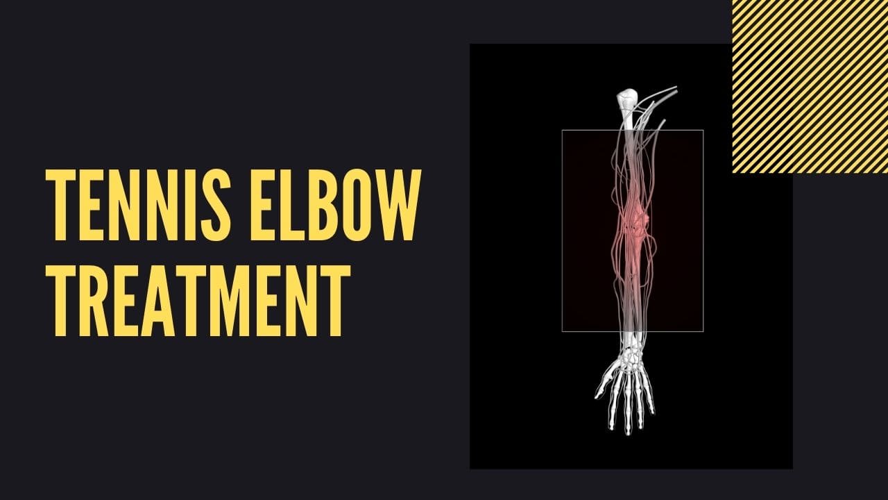 Tennis Elbow Treatment 