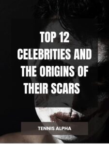Read more about the article Top 12 celebrities and the origins of their scars